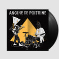 Vol. II- Angine De Poitrine