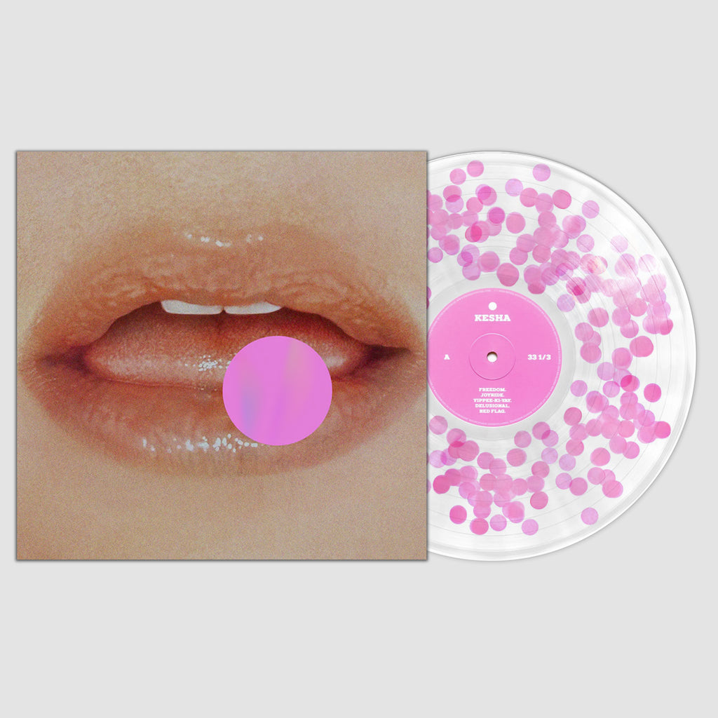 VV Exclusive:. (1 Year Anniversary Edition)- Kesha